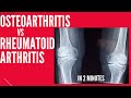 Osteoarthritis vs Rheumatoid arthritis in 2 mins!