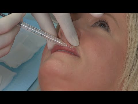 Do You Have RBF? There’s an Injection for That!