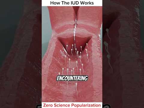 How The IUD Work || #iud