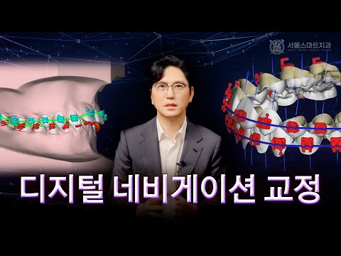 디지털 네비게이션 교정 vs 일반 교정, 어떤 걸로 해야할까?