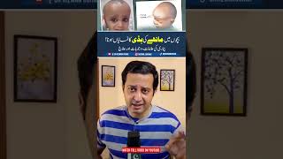 Prominent Forehead🙇‍♂️ in Kids.The Secret Treatment Unveiled! #frontal #bossing #treatment #rickets