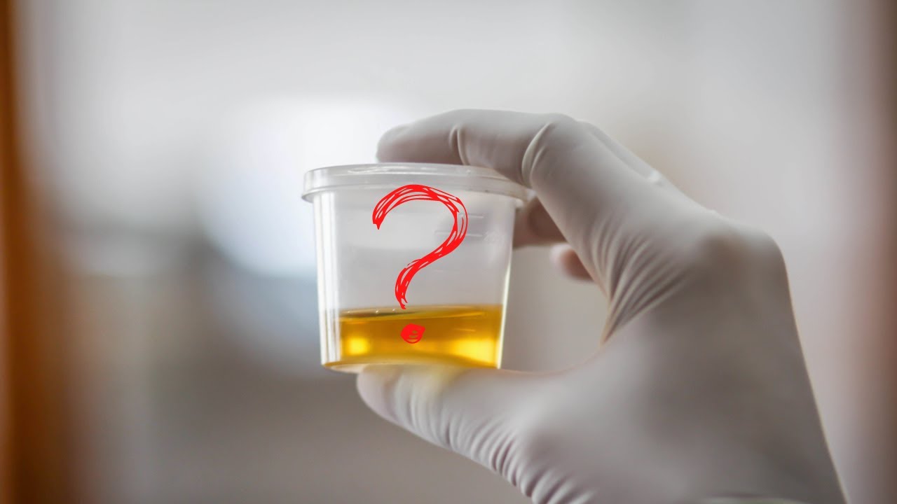 Can buprenorphine be detected in urine? Tipseri
