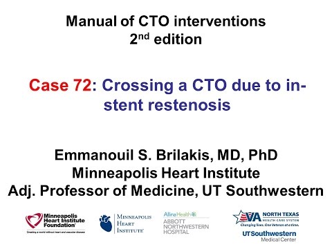 Case 72: Manual of CTO Interventions - Stent "crush" for in-stent CTO
