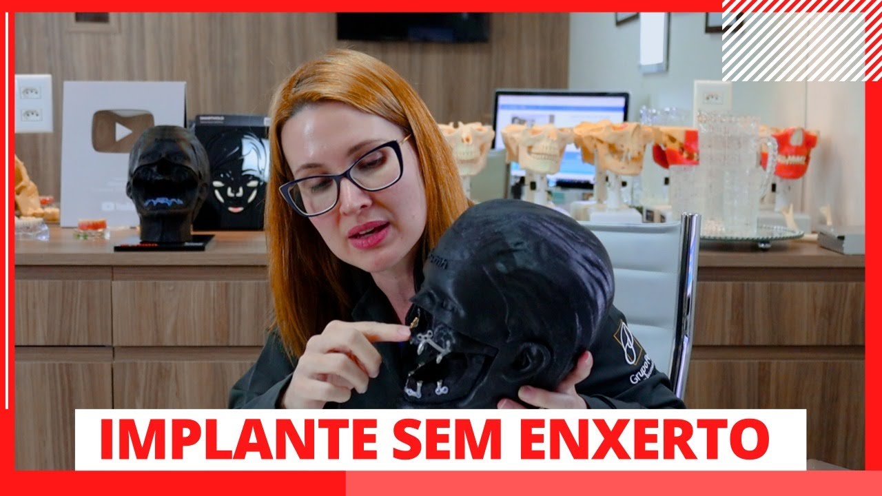 IMPLANTE SEM ENXERTO - PASSO A PASSO - DRA. DANIELLE SALES