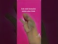 Cara Mudah Cek Otak Beresiko Stroke Atau Tidak
