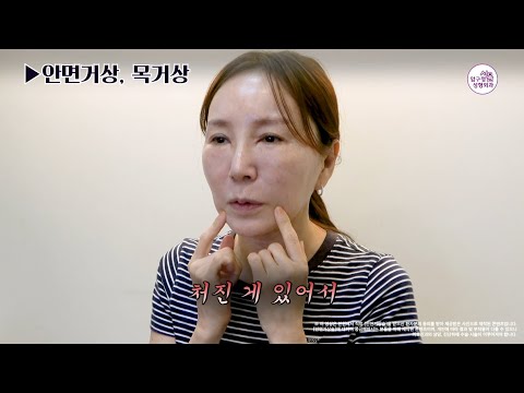  #안면거상 #목거상 더이상 목주름 안 가려도 됩니다