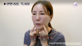 더이상 목주름 안 가려도 됩니다2