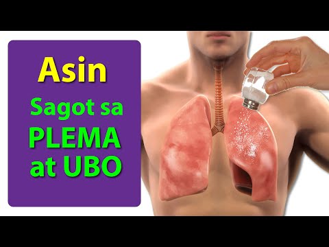 ASIN? TANGGAL ANG MUCUS AT PLEMA!