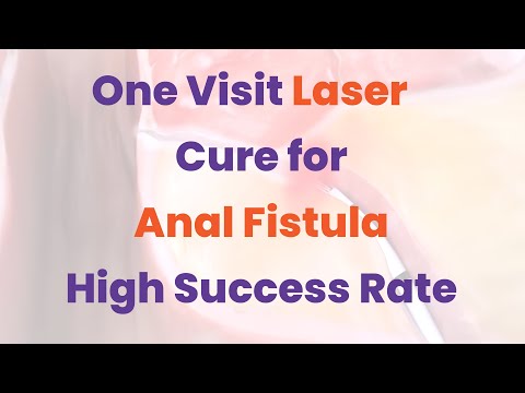Anal Fistula Treatment by Laser – Minimal Pain & Non-Surgical
