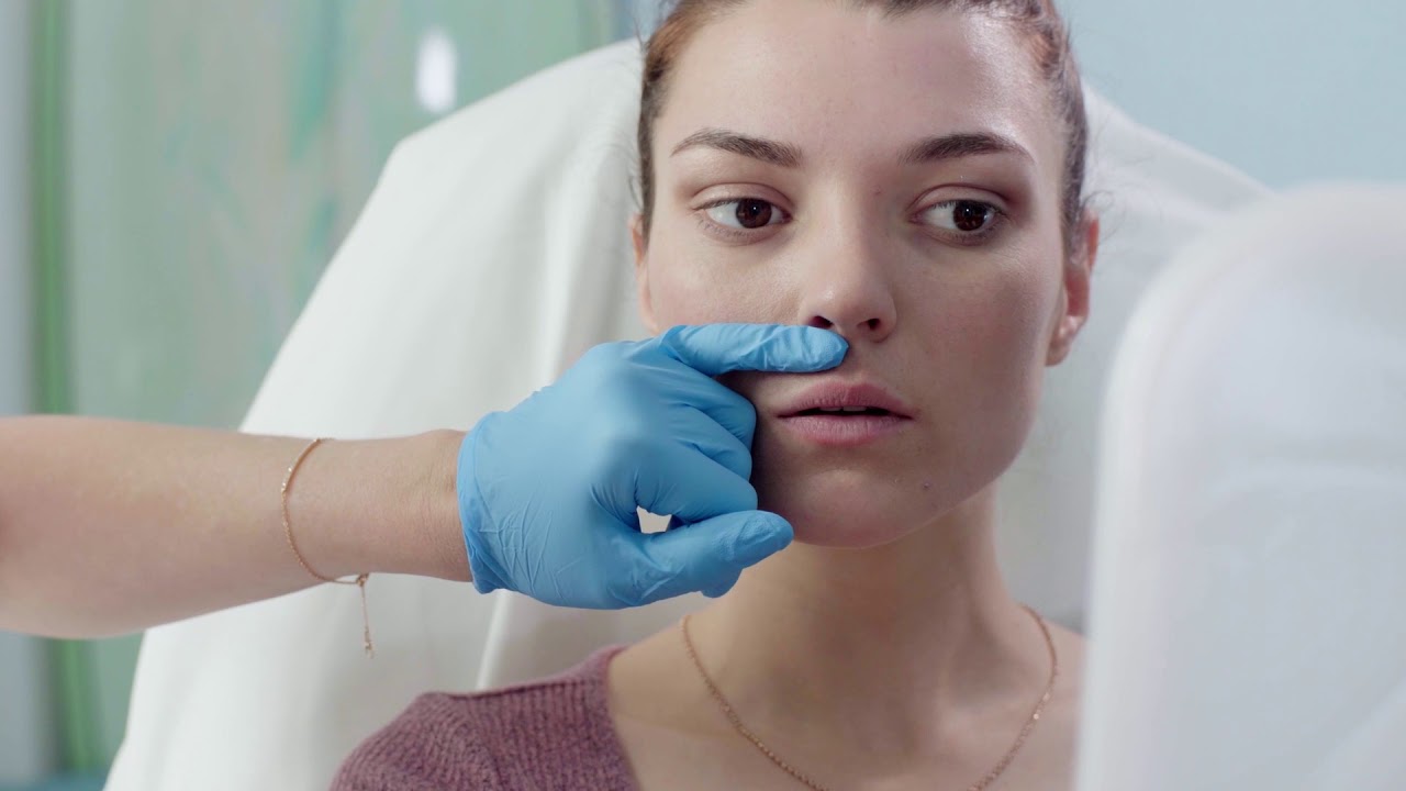 Dermal Fillers in Los Angeles Treatment Video