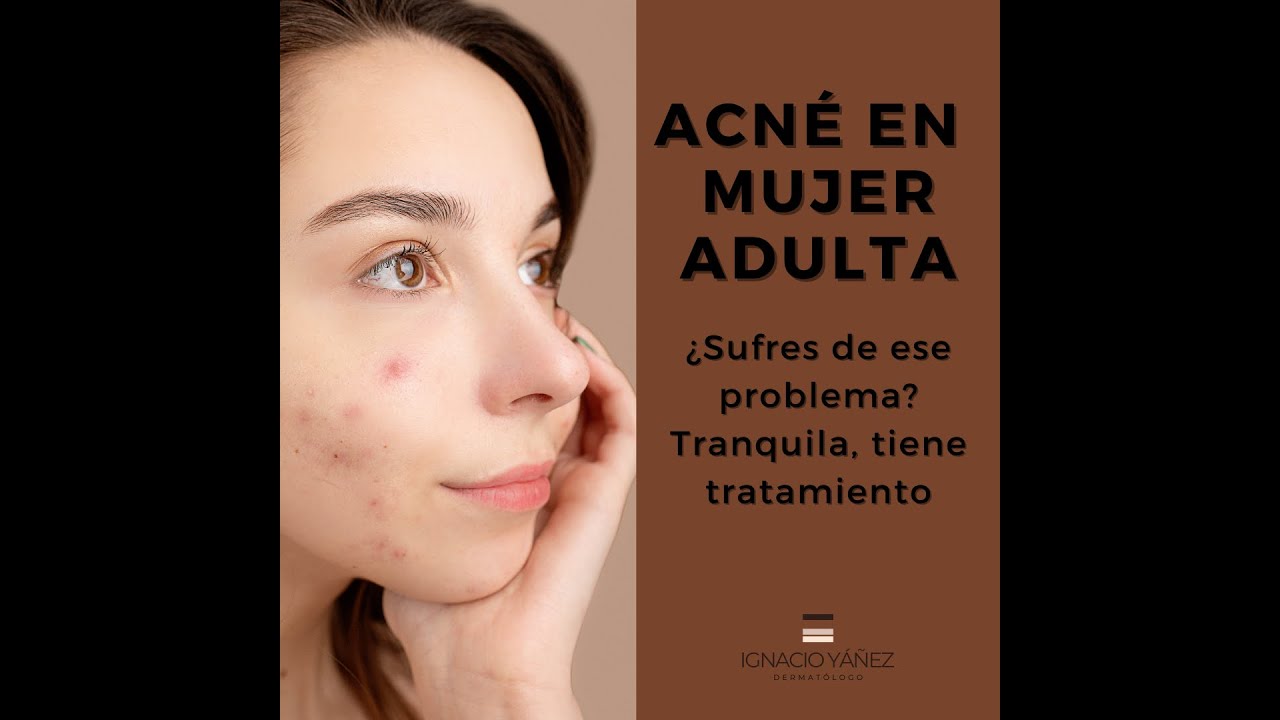 Ignacio Yáñez Silva-4