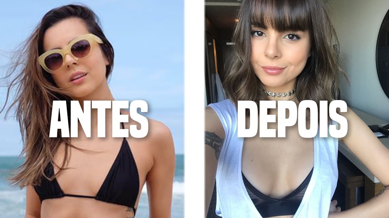 Watch Now SILICONE: PREÇO, TAMANHO, RECUPERAÇÃO E MAIS SILICONE: PREÇO, TAMANHO, RECUPERAÇÃO E MAIS