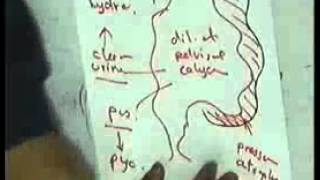 systemic pathology: renal system 4 chronic renal dieases DR SAMEH GHAZY