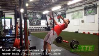 Blast Strap Scarecrows for Healthy Shoulders