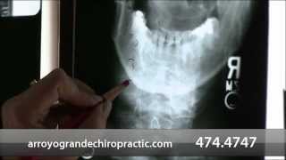 preview picture of video 'Bend Chiropractic Inc - Short | Arroyo Grande, CA'