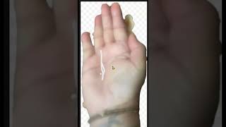 #Palmistry - Which Sun line gives bad result in Hand (English) Sun Line & Marks Or Sign #sun #line