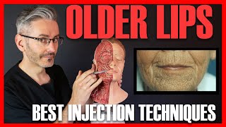 OLD LIPS: Best injection techniques & how to avoid the Homer Simpson look! [Aesthetics Mastery Show]