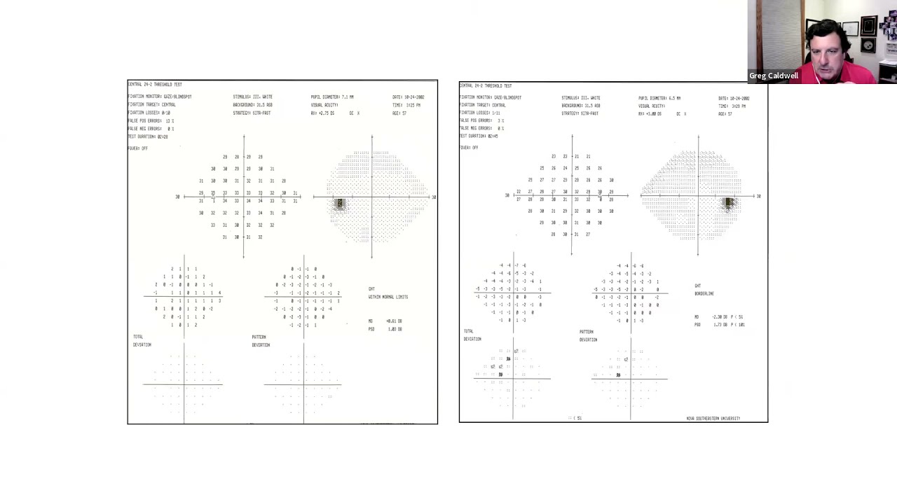 Glaucoma Clinical Case Conversations (12/20/2021)
