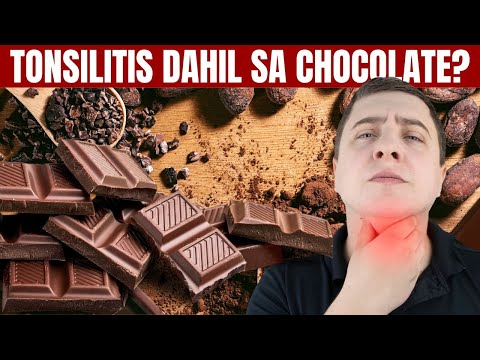 TONSILITIS DAHIL SA CHOCOLATE?