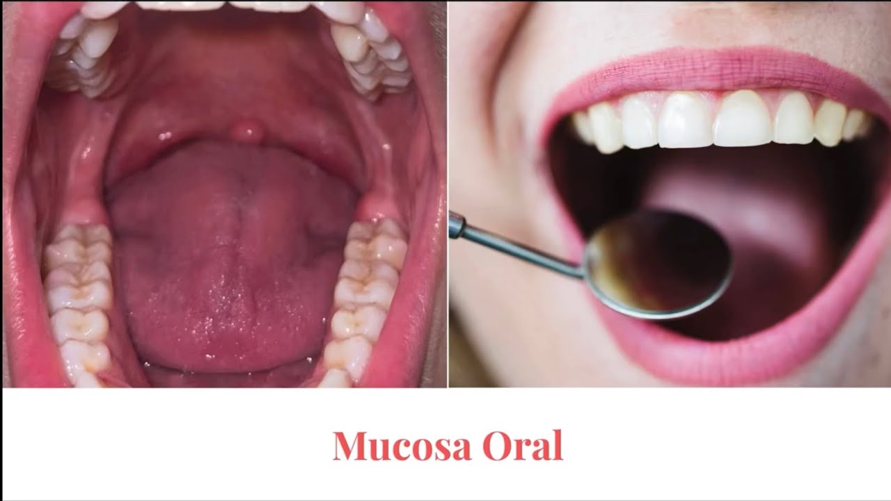 Mucosa oral