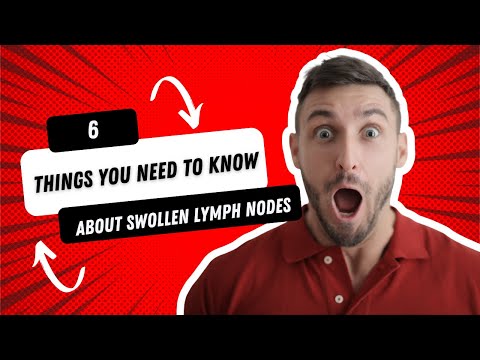 6 things you need to know about swollen lymph nodes (or swollen glands) #SpotLeukaemia