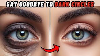 How To Get Rid of Dark Circles Under Eyes | How To Treat Dark Circles At Home Fast