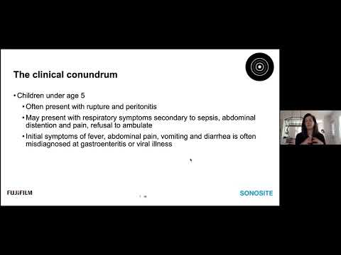 Webinar: Point-of-Care Ultrasound for Diagnosing Pediatric Appendicitis