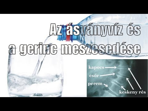 az erekció felemelésének eszköze)