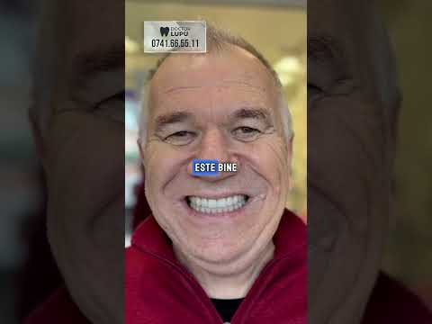 onial pacient implant dentar #implantdentar #onial #allon6