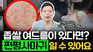 편평사마귀, HPV 바이러스가 원인이라고? 좁쌀여드름으로 속고 있었던 편평사마귀 원인부터 치료까지
