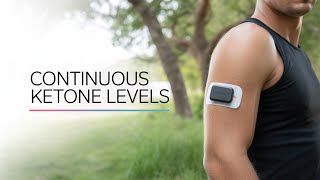 Ketone Patch Test: Surprising Results!