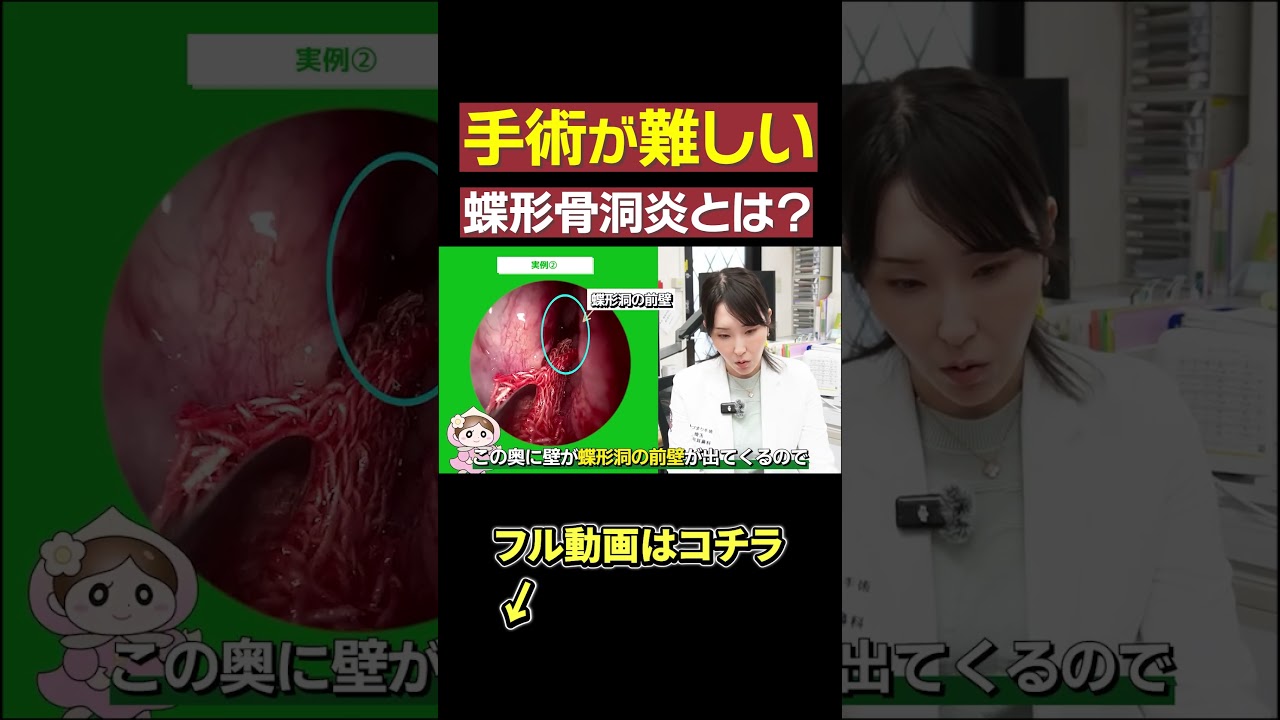 【頭痛の原因】耳鼻科の副鼻腔炎の手術はこうなっています