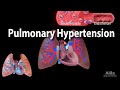 Pulmonary Hypertension Animation