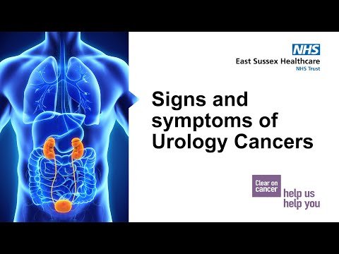 Signs and symptoms of Urology Cancers | Steve Garnett