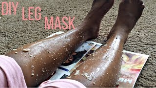 How To Get Rid Of Chicken Pox Scars, Mosquito Bite Scars, & Dark Marks On Legs