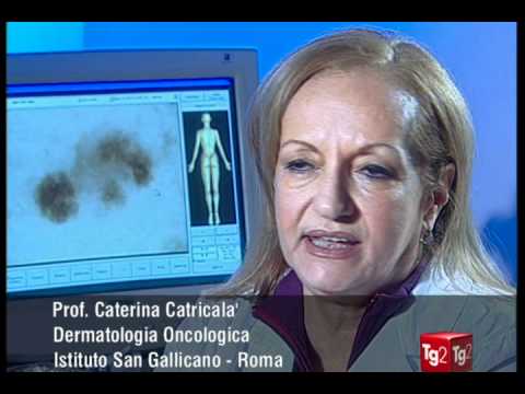 Come togliere la pigmentazione da una faccia Crema da pigmentazione di lakshma maxxi