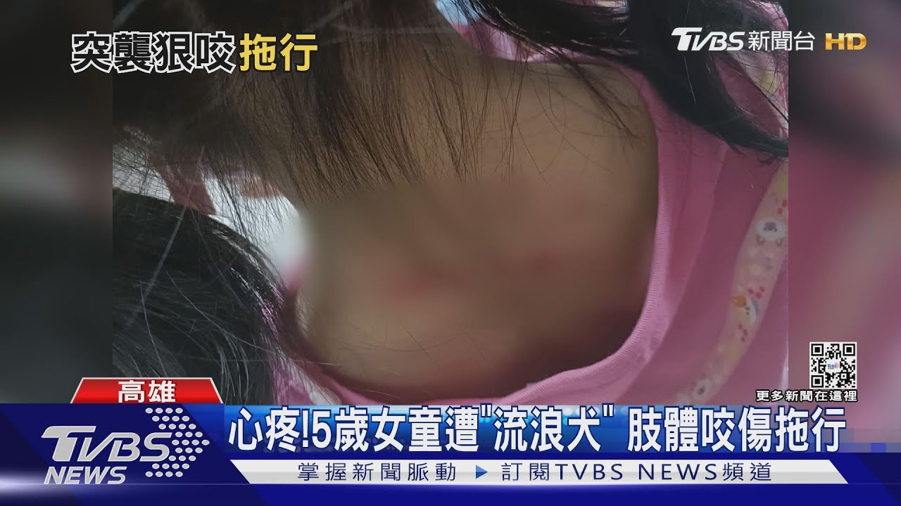 心疼! 五歲女童遭「流浪犬」咬住 大人拉不開