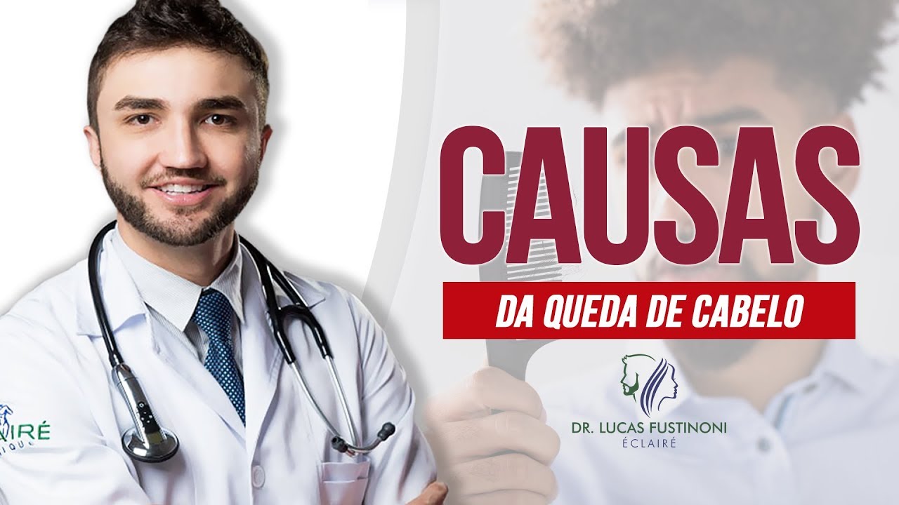 QUEDA DE CABELO: Principais Causas e Motivos da Alopécia | Dr Lucas Fustinoni