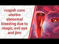 Ruqyah Cure Abnormal Uterine Bleeding Due To Magic Evil Eye And Jinn
