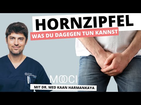 Was hilft bei Hornzipfeln an der Eichel?