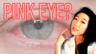 How Do I Know If I Have Pink Eye? | Common Causes Of Pink Eyes