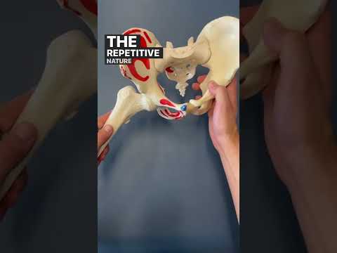 What is Femoral Acetabular Impingement (FAI) ?