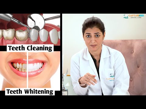 YouTube video about: Does teeth cleaning whiten?