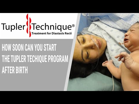 How Soon Can You Start the Tupler Techique Program after Birth