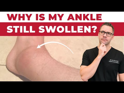 Heel Spurs Plantar Fasciitis BEST Home Treatment 2022