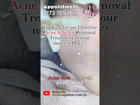Scar treatment কীভাবে করি