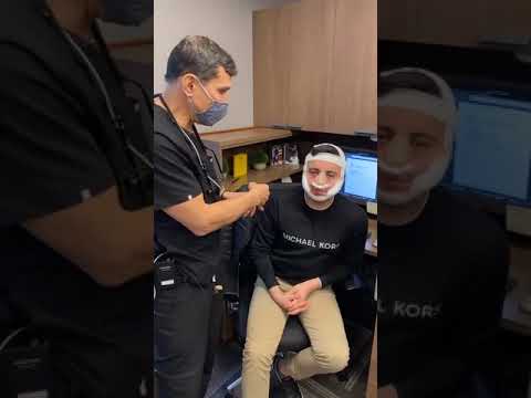 Male Rhinoplasty & Buccal Fat Removal Patient Returns to Work Just 2 Days After Surgery