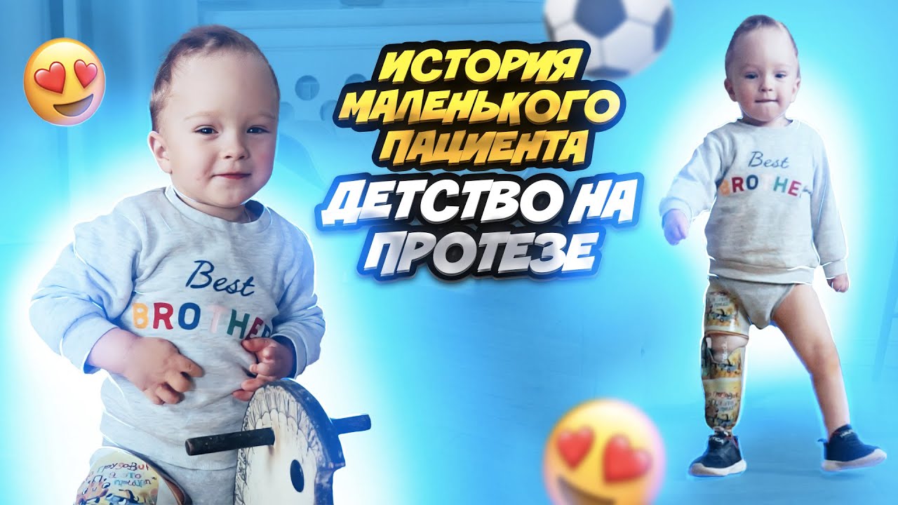 История маленького пациента INSTEP | Детство на протезе