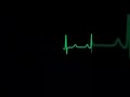 Heartbeat flatline sound HD