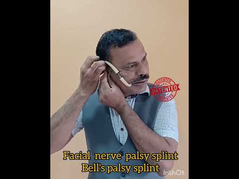 Facial clip or bells palsy splint